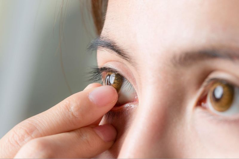 Người bệnh cần ngừng đeo kính áp tròng trong 7 ngày trước mổ loạn thị.