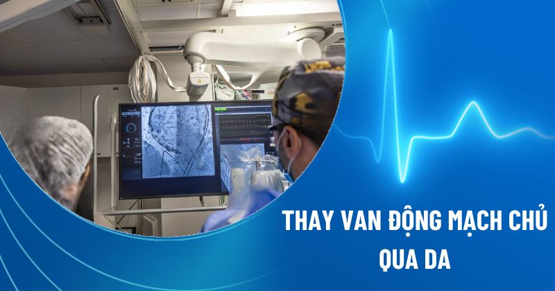 thay van động mạch chủ qua da