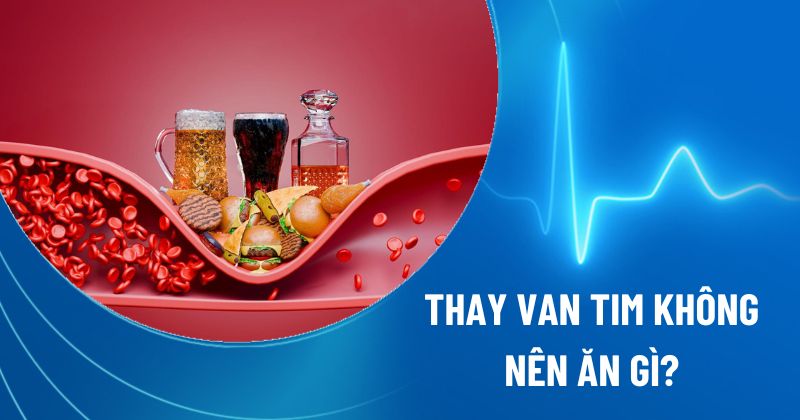 thay van tim không nên ăn gì?