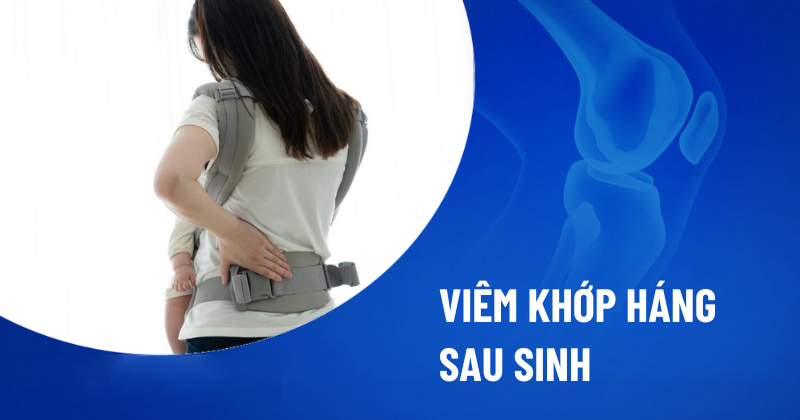 Viêm khớp háng sau sinh