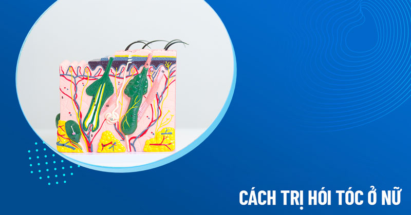 cách trị hói tóc ở nữ