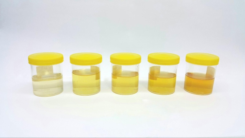 chữa viêm gan do thuốc