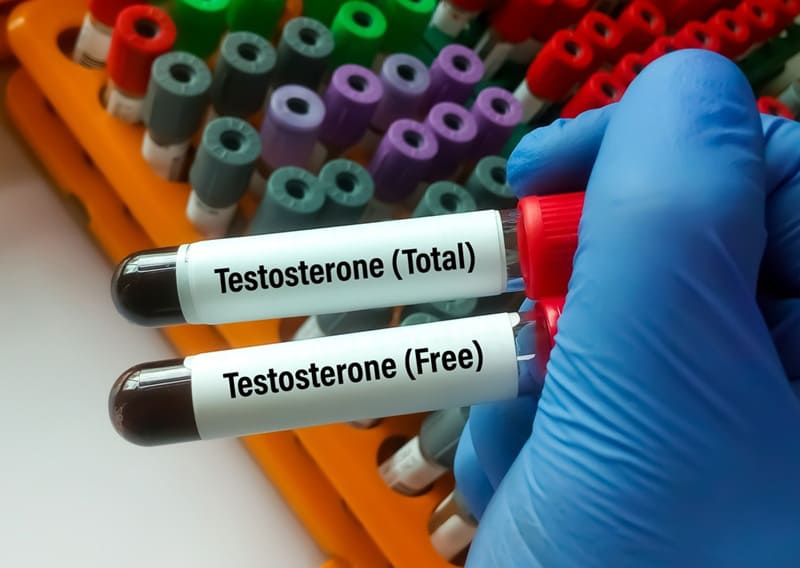 có 2 loại xét nghiệm testosterone phổ biến hiện nay