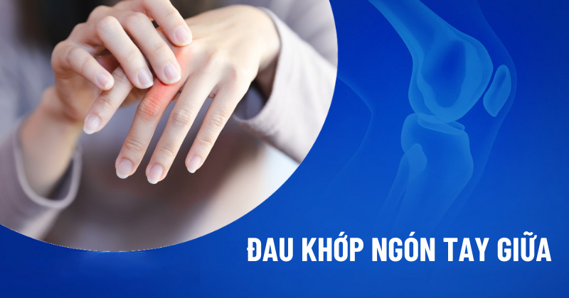 Đau khớp ngón tay giữa