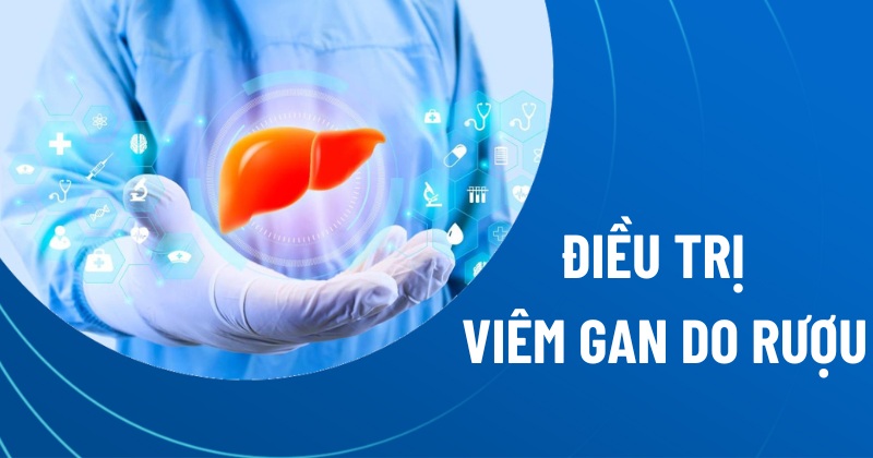 điều trị viêm gan do rượu