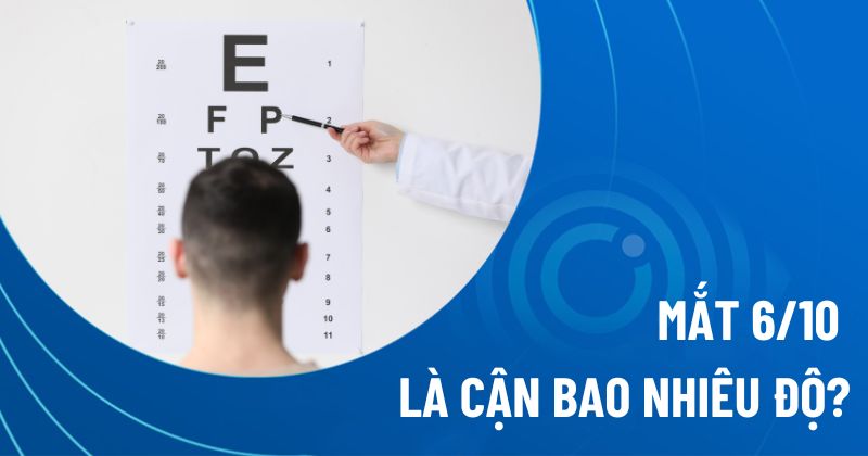 Mắt 6/10 là cận bao nhiêu độ