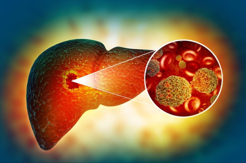 tác hại của bệnh gan nhiễm mỡ