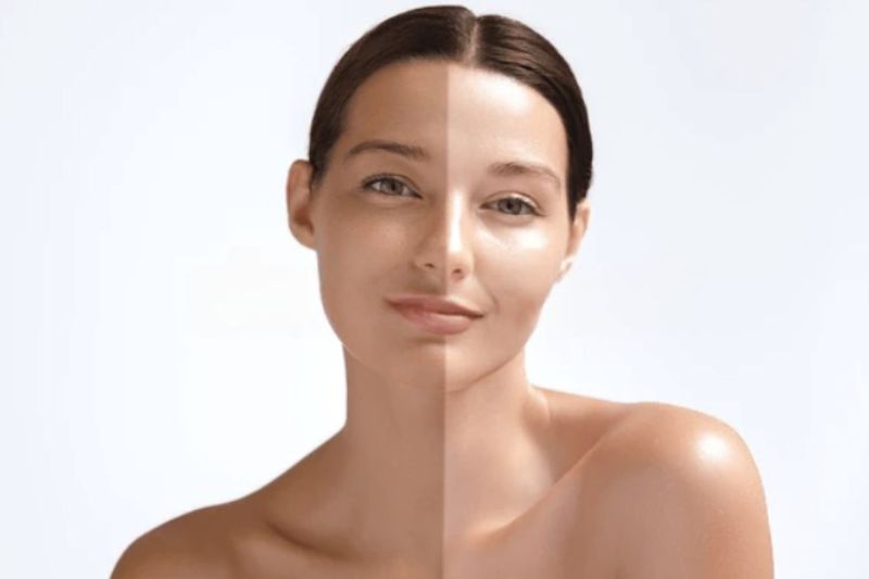 dùng serum vitamin C bị sạm da