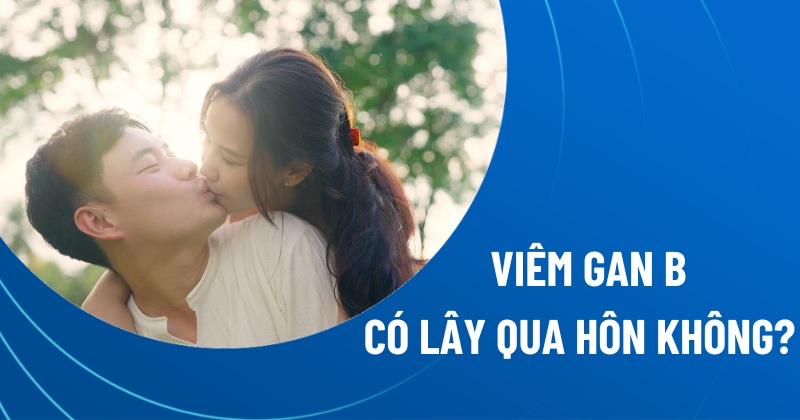 viêm gan b có lây qua hôn không