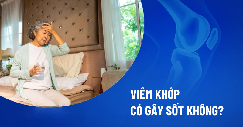 Viêm khớp có gây sốt không
