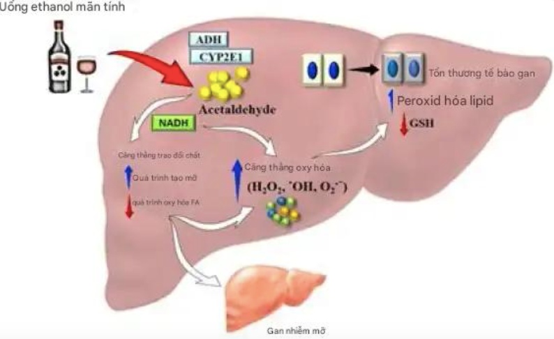 bệnh gan có nên uống rượu không