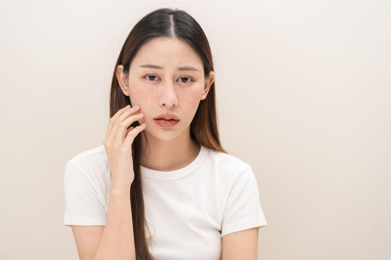 người bị sạm nám có thể dùng dầu oliu