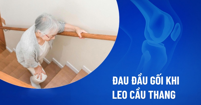 Đau đầu gối khi leo cầu thang
