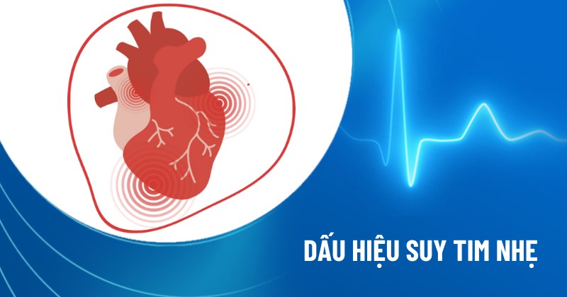 dấu hiệu suy tim nhẹ