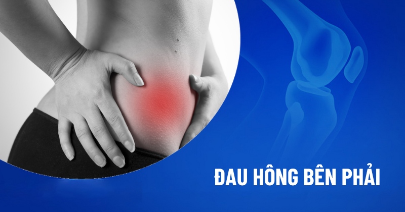 Đau hông bên phải