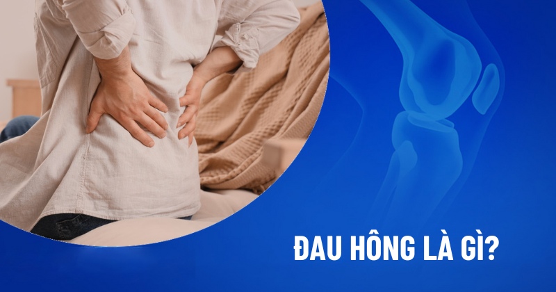 Đau hông