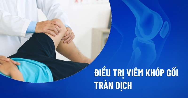 Điều trị viêm khớp gối tràn dịch