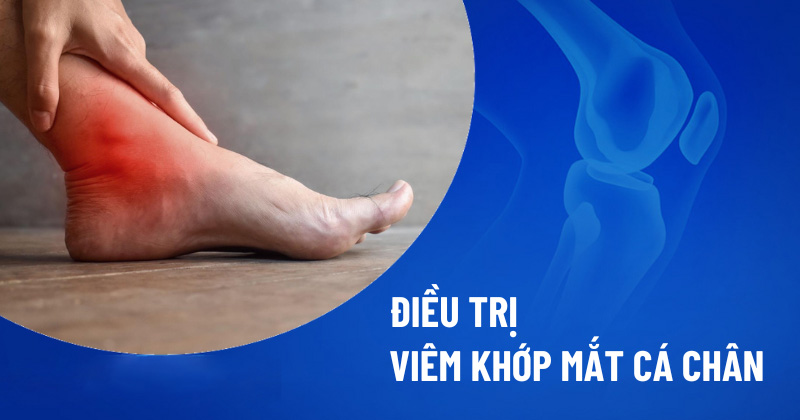 Điều trị viêm khớp mắt cá chân