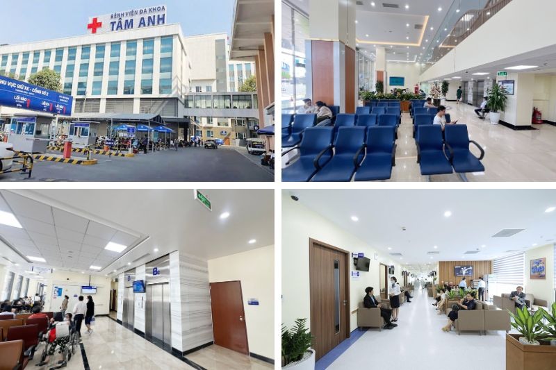 Khám đau hoogn tại bệnh viện Đa khoa Tâm Anh