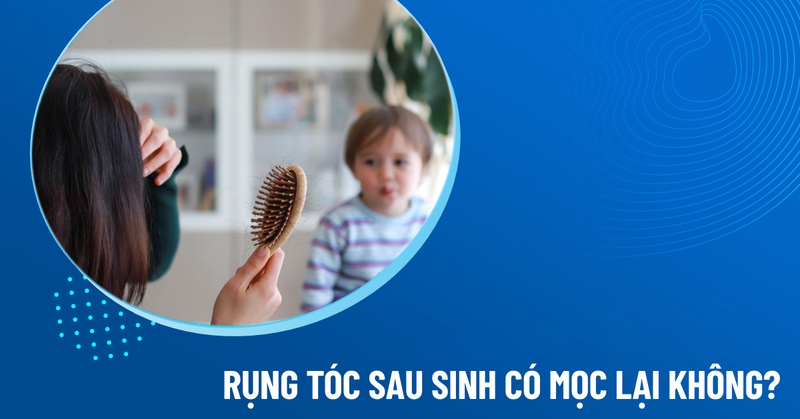 rụng tóc sau sinh có mọc lại không