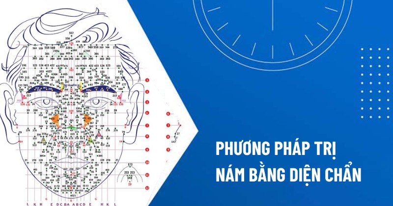 trị nám bằng diện chẩn