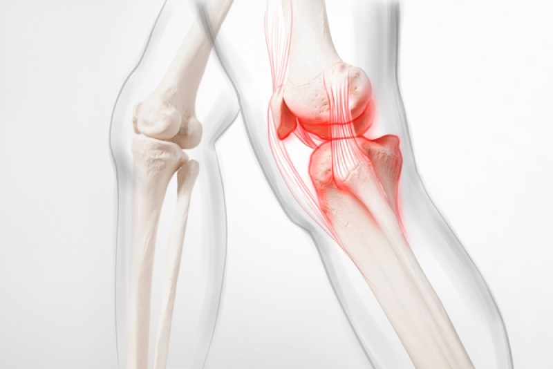 Uống rượu bia bị đau khớp