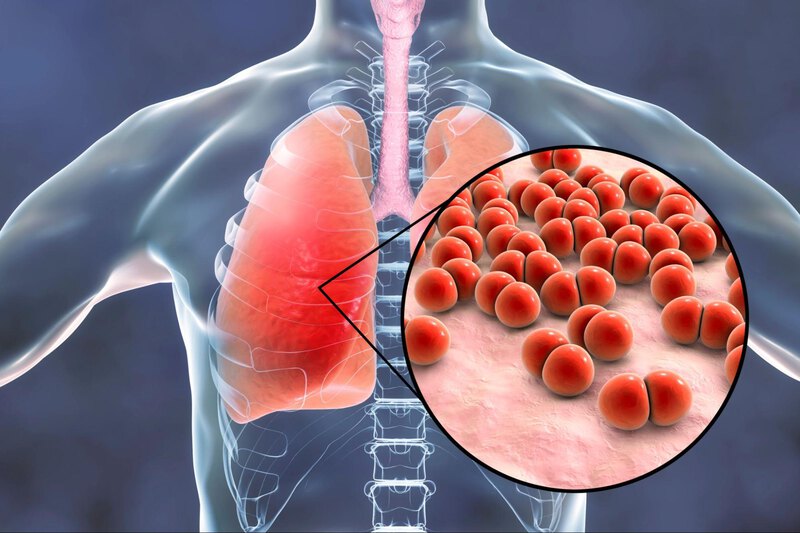 vắc xin prevenar 20 phòng ngừa các bệnh đường hô hấp