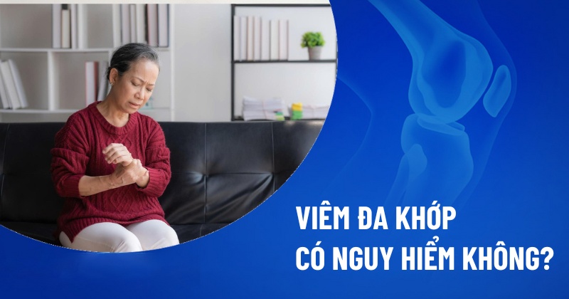 Viêm khớp có nguy hiểm không