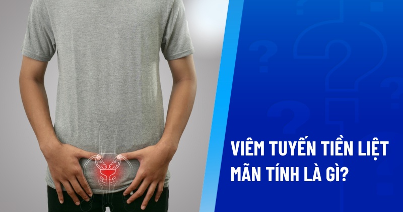 viêm tuyến tiền liệt mãn tính là gì