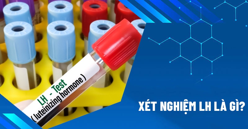 xét nghiệm lh là gì