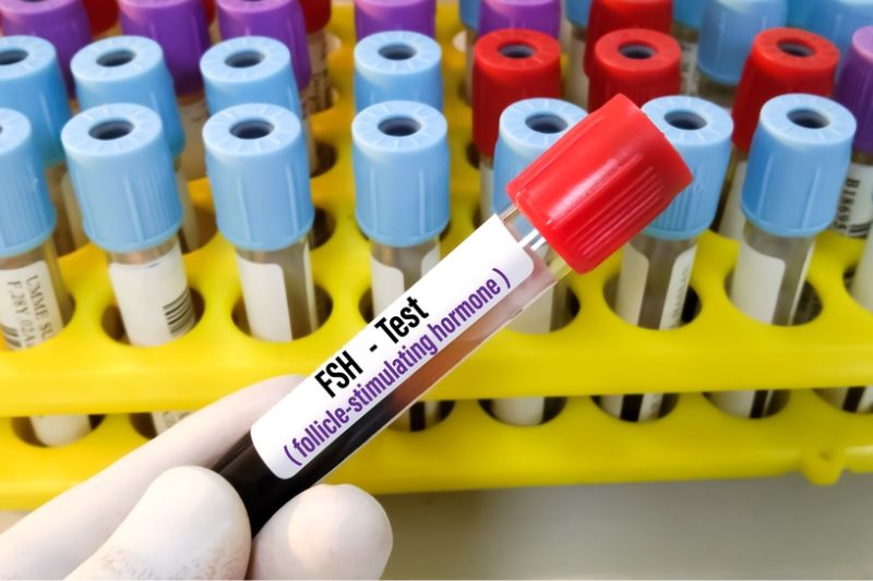 Xét nghiệm máu định lượng hormone kích thích nang trứng (FSH) giúp chẩn đoán mãn kinh đã xảy ra hay chưa.