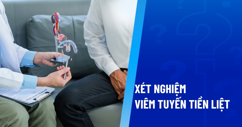 xét nghiệm viêm tuyến tiền liệt