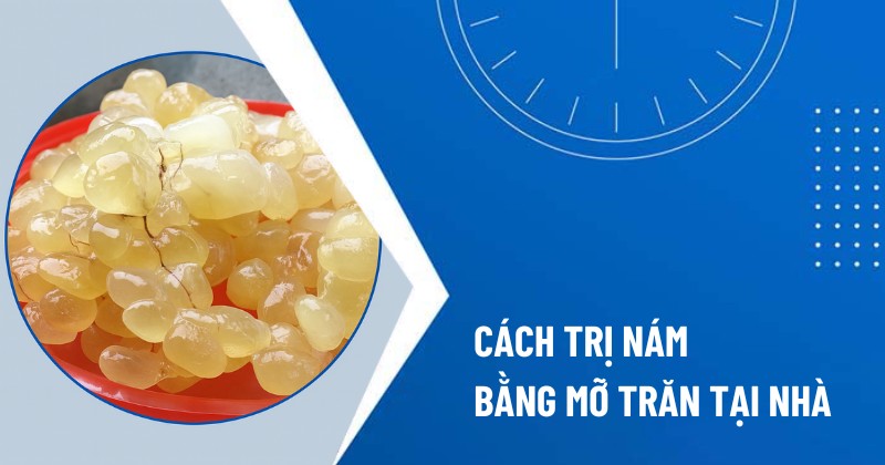 cách trị nám bằng mỡ trăn
