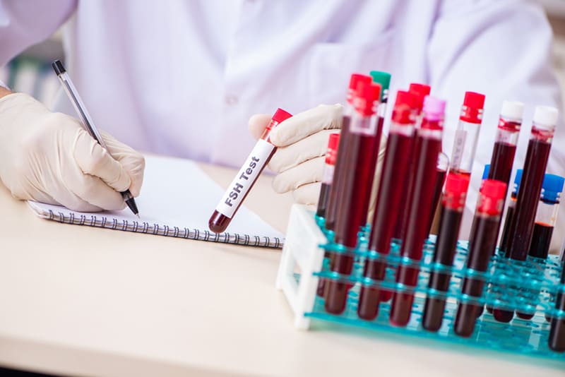 chỉ số fsh bình thường ở nam giới