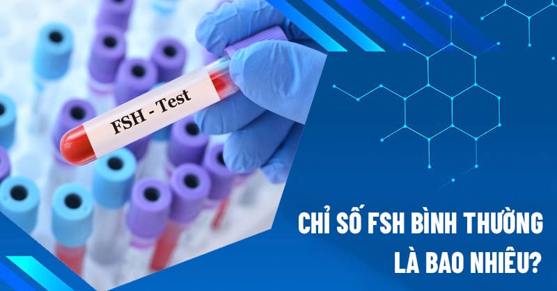 chỉ số fsh