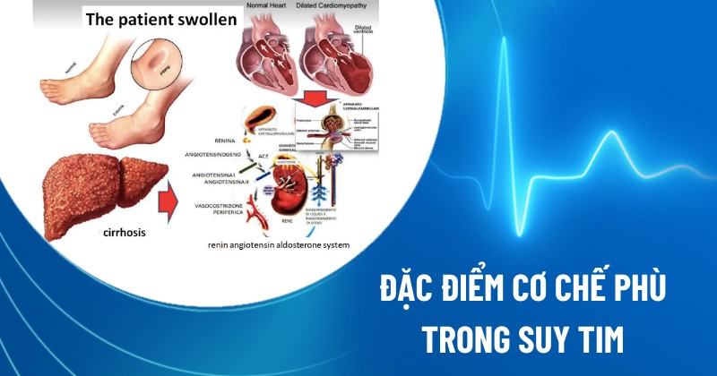 cơ chế phù trong suy tim
