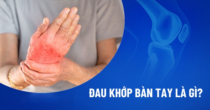 Đau khớp bàn tay