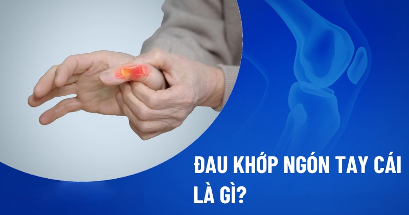 Đau khớp ngón tay cái