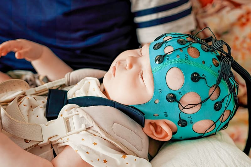 đo đa ký có thể được chỉ định ở trẻ em