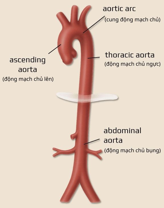 động mạch chủ có 4 phần chính