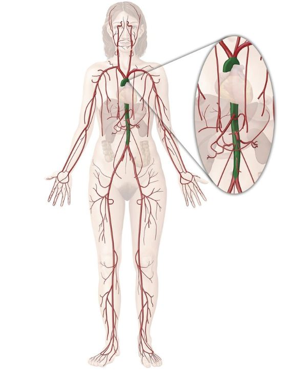 động mạch chủ xuất phát từ tâm thất trái tim