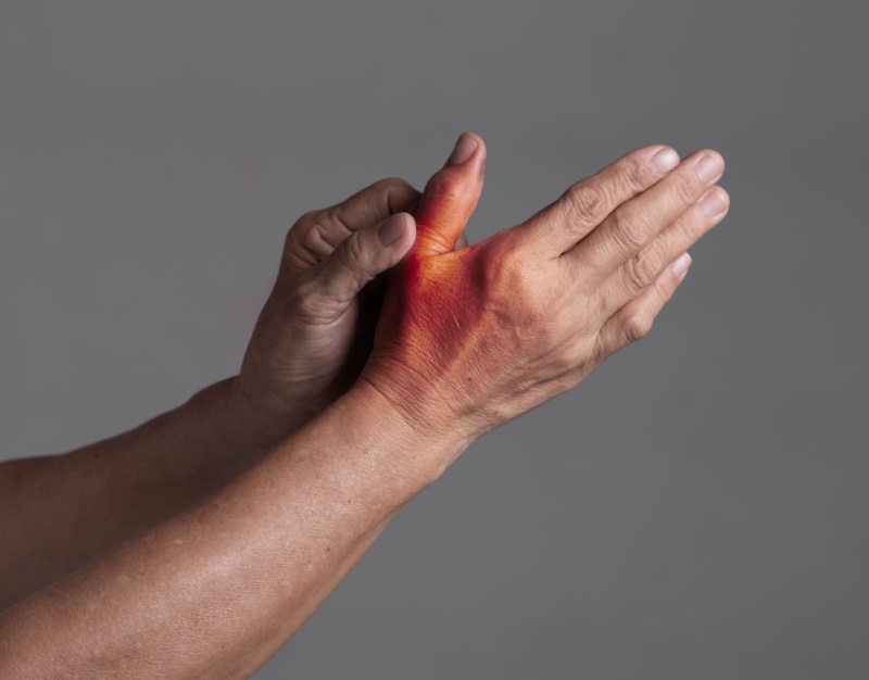 Ngón tay cái bị đau do chấn thương phần mềm