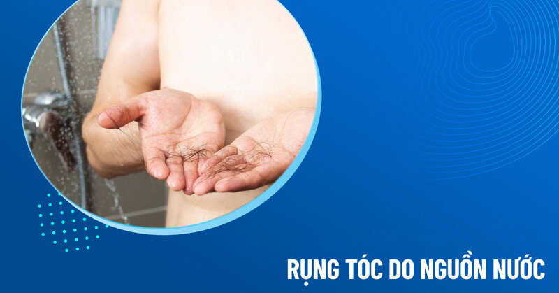 rụng tóc do nguồn nước