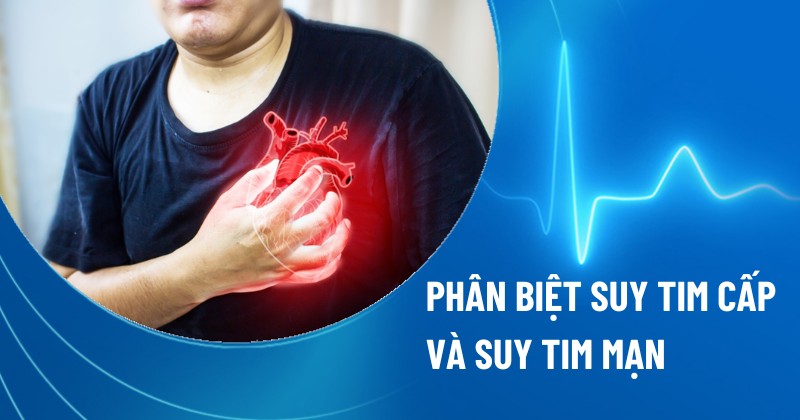 suy tim cấp và suy tim mạn