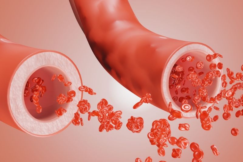 lưu thông máu suy tim còn bù