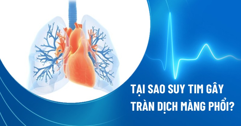 suy tim gây tràn dịch màn phổi
