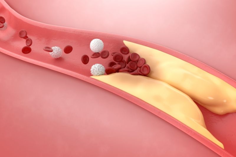 suy tim không đặc hiệu có thể do bệnh tim mạch