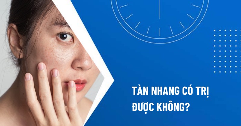 tàn nhang có trị được không