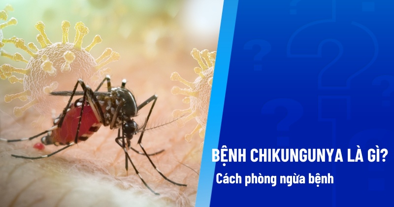 bệnh chikungunya