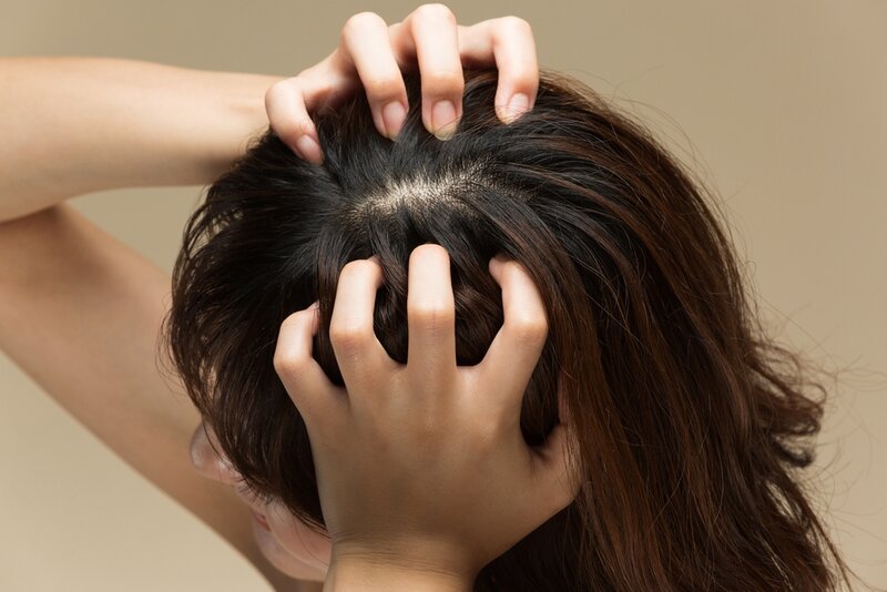 da đầu ngứa ngáy khó chịu